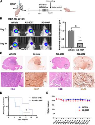 Selective and brain-penetrant ACSS2 inhibitors target breast cancer brain metastatic cells